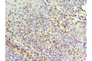 Immunohistochemistry of paraffin-embedded human tonsil tissue using ABIN7156854 at dilution of 1:100 (IL22 Receptor alpha 1 Antikörper  (AA 16-230))