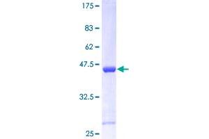 CDKN2C Protein (AA 1-168) (GST tag)