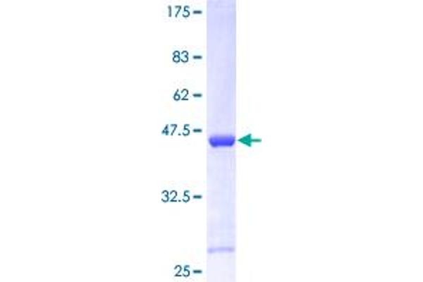 CDKN2C Protein (AA 1-168) (GST tag)