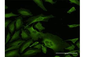 Immunofluorescence of purified MaxPab antibody to CAP1 on HeLa cell. (CAP1 Antikörper  (AA 1-475))