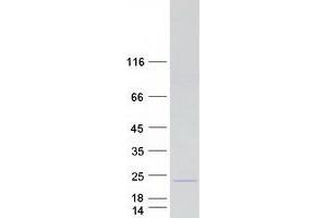 Western Blotting (WB) image for Ribosomal Protein L12 (RPL12) protein (Myc-DYKDDDDK Tag) (ABIN2731125)