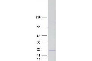 Validation with Western Blot (RPL12 Protein (Myc-DYKDDDDK Tag))