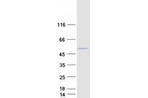 Western Blotting (WB) image for Abhydrolase Domain Containing 2 (ABHD2) (Transcript Variant 2) protein (Myc-DYKDDDDK Tag) (ABIN2714277)