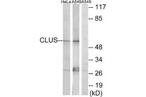 Western blot analysis of extracts from HeLa cells and A549 cells, using CLUS antibody.