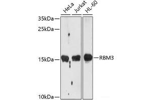 Western blot analysis of extracts of various cell lines using RBM3 Polyclonal Antibody at dilution of 1:1000. (RBM3 Antikörper)