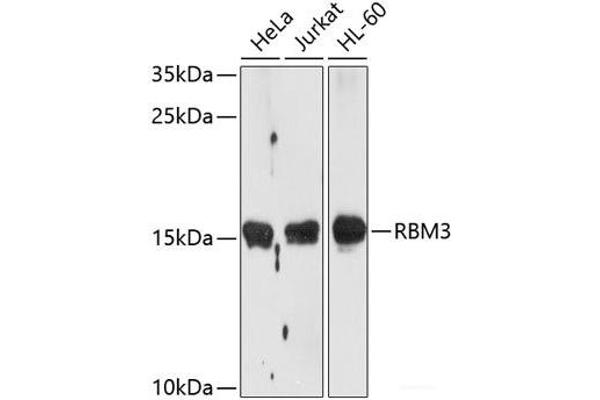 RBM3 Antikörper