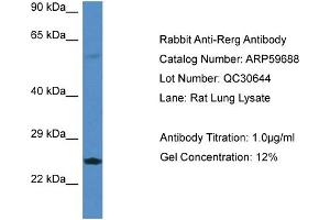 Western Blotting (WB) image for anti-RAS-Like, Estrogen-Regulated, Growth Inhibitor (RERG) (Middle Region) antibody (ABIN2788162) (RERG Antikörper  (Middle Region))