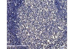 IHC analysis of SNAP23 using anti-SNAP23 antibody (ABIN7603236). (SNAP23 Antikörper  (N-Term))