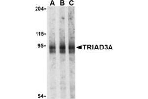 Western blot analysis of TRIAD3A in mouse heart cell lysates with this product at (A) 0. (RNF216 Antikörper  (N-Term))