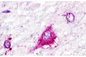 Image no. 1 for anti-G Protein-Coupled Receptor 22 (GPR22) (Cytoplasmic Domain) antibody (ABIN1048780) (GPR22 Antikörper  (Cytoplasmic Domain))