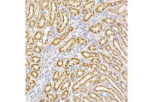 Immunohistochemistry of paraffin-embedded mouse kidney using UQCRH Rabbit mAb (ABIN7271126) at dilution of 1:50 (40x lens). (UQCRH Antikörper)