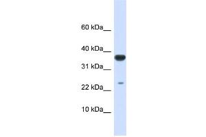 WB Suggested Anti-UBE2D2 Antibody Titration:  0. (UBE2D2 Antikörper  (Middle Region))