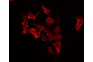 ABIN6275676 staining HeLa by IF/ICC. (CACNG1 Antikörper  (Internal Region))
