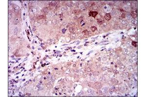 Immunohistochemistry (IHC) image for anti-Enolase 2 (Gamma, Neuronal) (ENO2) (AA 251-433) antibody (ABIN1846262) (ENO2/NSE Antikörper  (AA 251-433))