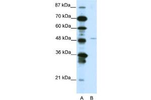 WB Suggested Anti-MEOX2 Antibody Titration:  1. (MEOX2 Antikörper  (N-Term))
