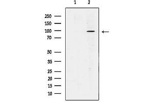 anti-WW Domain Containing E3 Ubiquitin Protein Ligase 1 (WWP1) (Internal Region) antibody