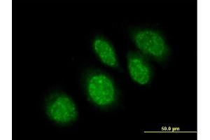 Immunofluorescence of purified MaxPab antibody to RBBP9 on HeLa cell. (RBBP9 Antikörper  (AA 1-186))