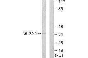 Western blot analysis of extracts from HUVEC cells, using SFXN4 antibody. (Sideroflexin 4 Antikörper  (N-Term))