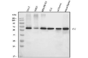 Western blot analysis of YY1 using anti-YY1 antibody (ABIN7603001).