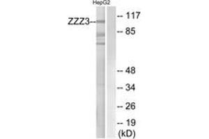 Western Blotting (WB) image for anti-Zinc Finger, ZZ-Type Containing 3 (ZZZ3) (AA 341-390) antibody (ABIN2890702) (ZZZ3 Antikörper  (AA 341-390))
