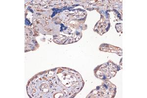Immunohistochemistry of paraffin-embedded human placenta using IGF2 Rabbit pAb (ABIN3022872, ABIN3022873, ABIN3022874 and ABIN6219274) at dilution of 1:100 (40x lens). (IGF2 Antikörper  (AA 25-180))