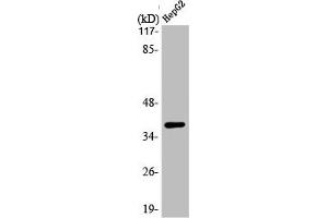 Western Blotting (WB) image for anti-Calcium Channel, Voltage-Dependent, gamma Subunit 7 (CACNG7) (C-Term) antibody (ABIN7185085)