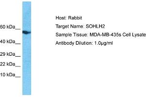 Host: Rabbit Target Name: SOHLH2 Sample Tissue: Human MDA-MB-435s Whole Cell Antibody Dilution: 1ug/ml (SOHLH2 Antikörper  (N-Term))