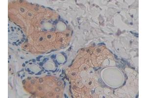 Detection of FABP9 in Rat Skin Tissue using Polyclonal Antibody to Fatty Acid Binding Protein 9, Testis (FABP9) (FABP9 Antikörper  (AA 1-130))