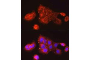 Immunofluorescence analysis of MCF7 cells using ZO-1 Rabbit pAb (ABIN1513706, ABIN3021026, ABIN3021027 and ABIN6213922) at dilution of 1:150 (40x lens).