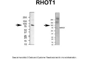 mouse brain and human neuroblastoma (RHOT1 Antikörper  (N-Term))