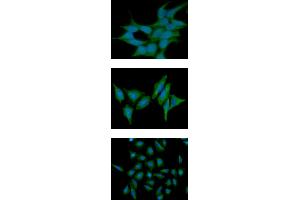 ICC/IF analysis of ST13 in 293T cells line, stained with DAPI (Blue) for nucleus staining and monoclonal anti-human ST13 antibody (1:100) with goat anti-mouse IgG-Alexa fluor 488 conjugate (Green). (HSC70 Interacting Protein HIP Antikörper  (AA 1-369))