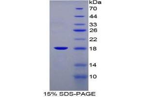 SDS-PAGE analysis of Mouse FABP1 Protein.
