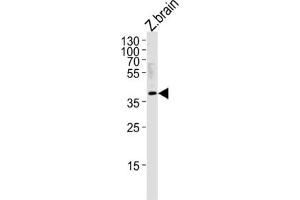 Western Blotting (WB) image for anti-Hairy/enhancer-of-Split Related with YRPW Motif 2 (HEY2) antibody (ABIN3004672) (HEY2 Antikörper)