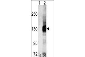 Western blot analysis of CASK (arrow) using Cask Antibody (C-term) (ABIN391318 and ABIN2841347).