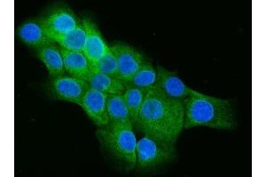 IF analysis of Cip4/TRIP10 using anti-Cip4/TRIP10 antibody (ABIN7599045).