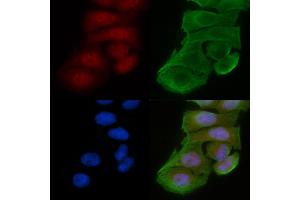 ABIN6256048 and ABIN6274078 staining Hela cells(30 min of UV treatment) by IF/ICC.