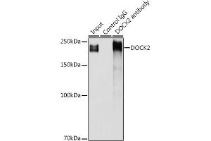 Immunoprecipitation analysis of 300 μg extracts of Jurkat cells using 3 μg DOCK2 antibody (ABIN1679578, ABIN5664348 and ABIN5664349). (DOCK2 Antikörper  (AA 1551-1830))