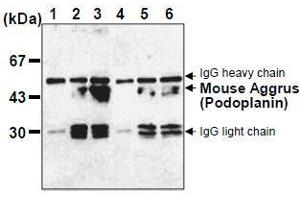 Western Blotting (WB) image for anti-Podoplanin (PDPN) antibody (ABIN1449217) (Podoplanin Antikörper)