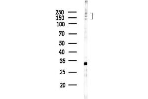 anti-RNA Binding Motif Protein 16 (RBM16) (Internal Region) antibody