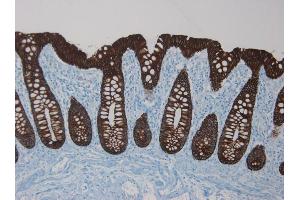 Immunohistochemistry on paraffin section of human colon (Cytokeratin 18 Antikörper)