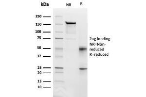 SDS-PAGE Analysis Purified CD95 Mouse Monoclonal Antibody (FAS/3112). (FAS Antikörper  (AA 26-96))