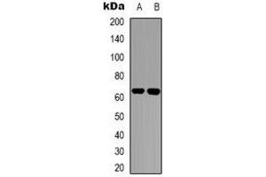 Western blot analysis of ZNF384 expression in Hela (A), Jurkat (B) whole cell lysates.