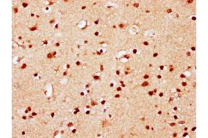 IHC image of nsucHU diluted at 1:10 and staining in paraffin-embedded human brain tissue performed on a Leica BondTM system. (HIST1H2AG Antikörper  (AA 86-98))