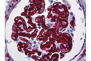 Anti-CD34 antibody IHC of human kidney, glomeruli. (CD34 Antikörper)