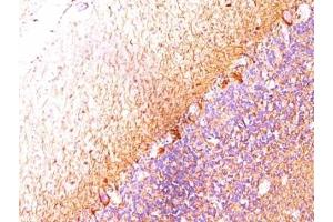 Formalin-fixed, paraffin-embedded human cerebellum stained with Neurofilament antibody (RT-97 + NR-4). (Neurofilament Antikörper)