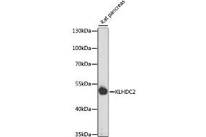 Western blot analysis of extracts of rat pancreas, using KLHDC2 antibody  at 1:1000 dilution. (KLHDC2 Antikörper  (AA 1-240))