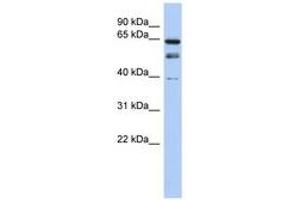 Image no. 1 for anti-MYST Histone Acetyltransferase 2 (MYST2) (N-Term) antibody (ABIN6740262) (MYST2 Antikörper  (N-Term))