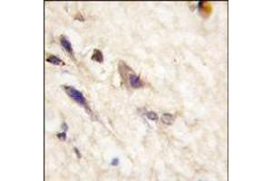 Formalin-fixed and paraffin-embedded human brain tissue reacted with EphA5 antibody (N-term), which was peroxidase-conjugated to the secondary antibody, followed by DAB staining. (EPH Receptor A5 Antikörper  (N-Term))