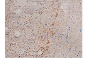 ABIN6267353 at 1/200 staining Mouse brain tissue sections by IHC-P. (MAPT Antikörper  (pSer214))