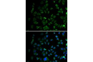 Immunofluorescence analysis of U2OS cells using MAP2K1 antibody. (MEK1 Antikörper  (AA 1-100))